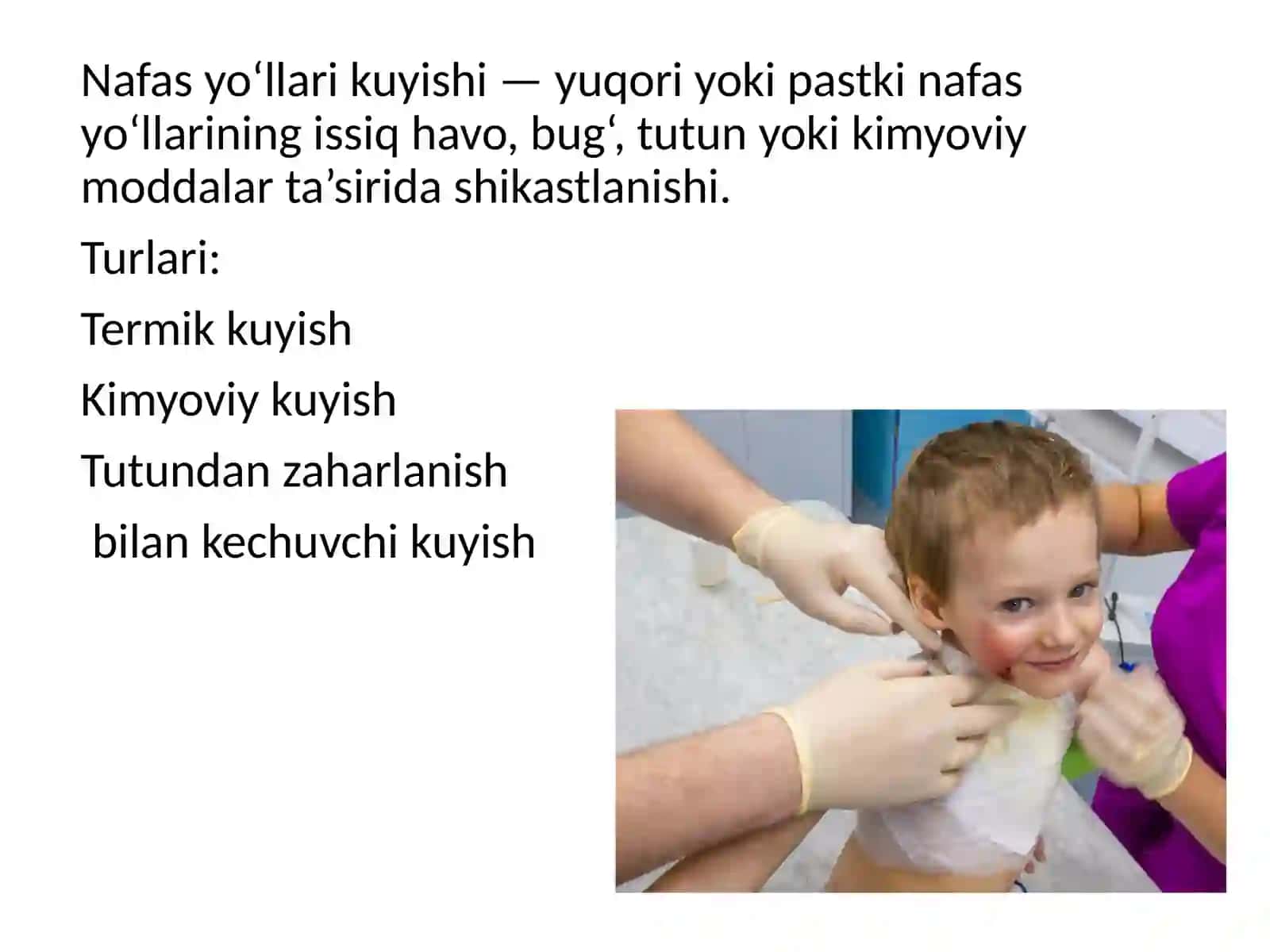 Bolalarda nafas yo‘llari kuyishi 3