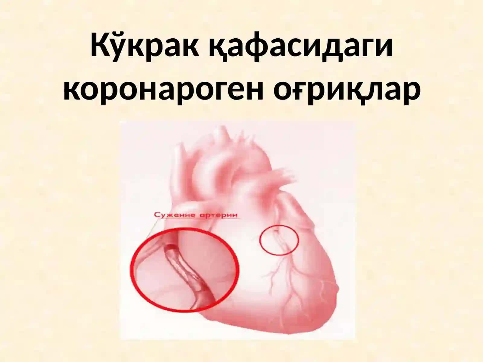 Кўкракқафасидаги оғриқларнингсолиштирма ташхиси. Коронароген ва нокоронароген оғриқларнинг дифференциал диагностикаси.УАШ тактикаси. Даволашва профилактикаси 3