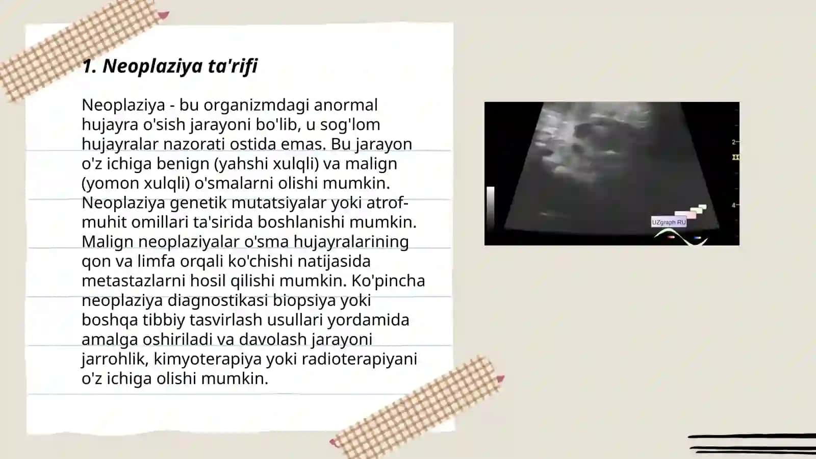 Neoplaziya 3