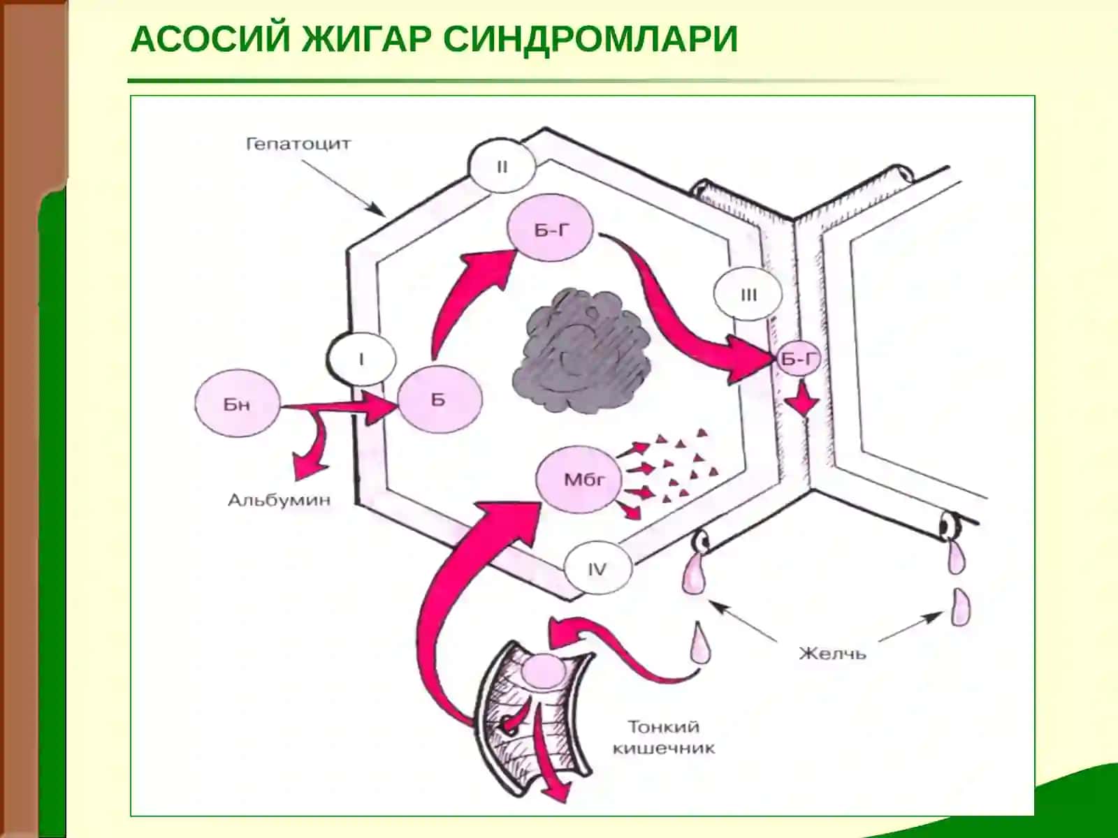 Жигар касалликларидаги асосий клиник синдромлар 3