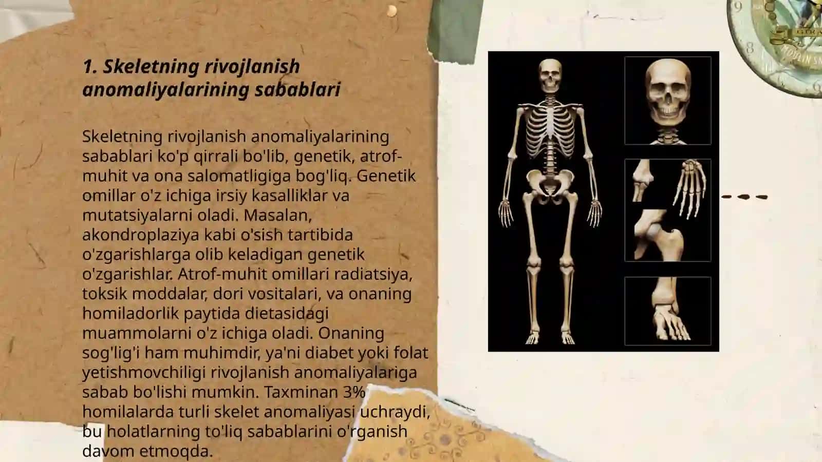 Skeletning rivojlanish anomaliyalari 3