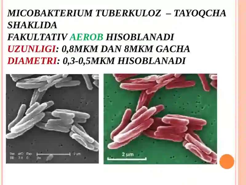 Pathogenesis of Tuberculosis (TB) 3