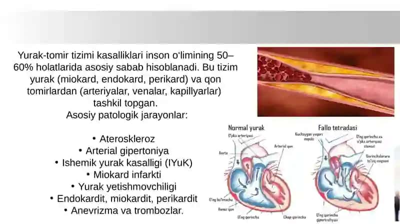YURAK-TOMIR TIZIMI KASALLIKLARI BO’YICHA DIAGNOZLAR TUZISH VA O’LIM HAQIDAGI MA’LUMOTNOMA 3