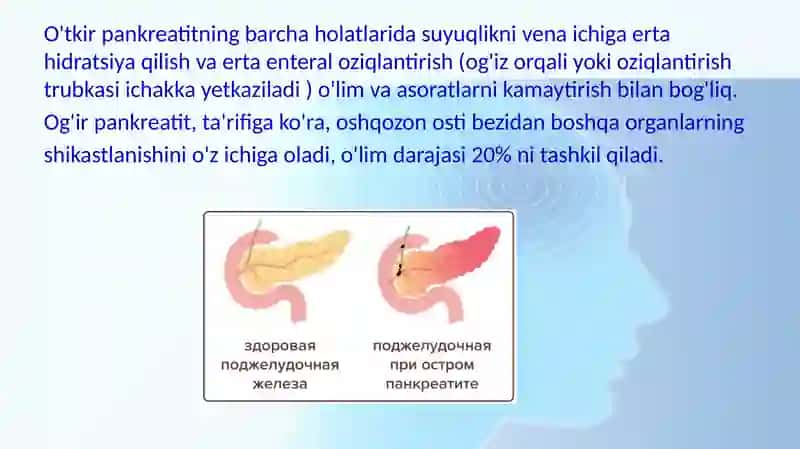 Otkir pankreatit 3