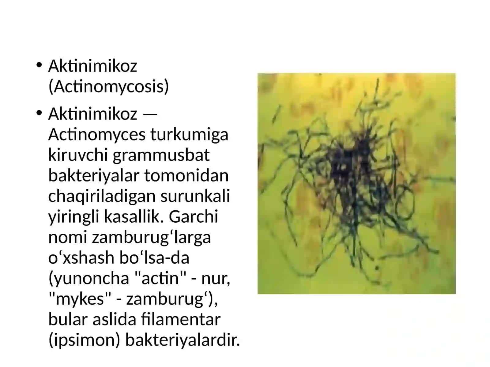 Aktinimikoz qo'zg'atuvchilari tavsifi va ular keltirib chiqargan kassalliklar tashxisi.Atipik mikobakteriyalar va ularni amaliyotdagi ahamiyati ular keltirib chiqargan kassaliklar tashxisi 3