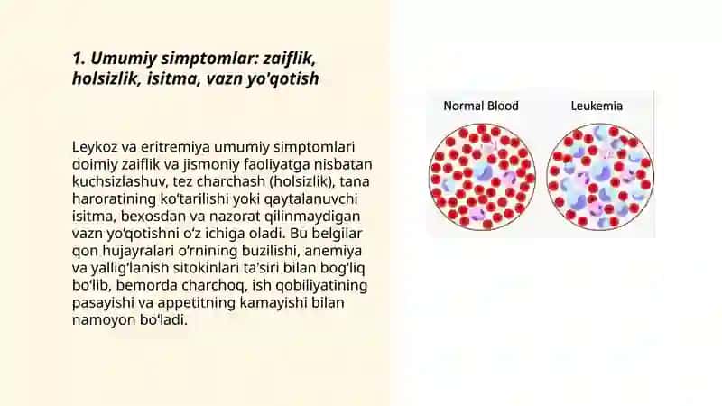 Leykozlar Eritremiya simptamotalogiyasi 3