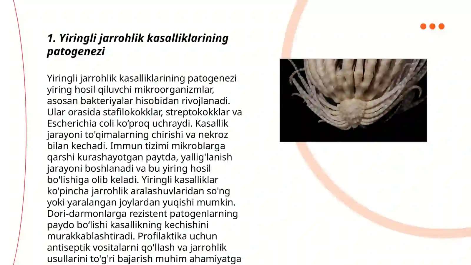 Yiringli xirurgik kasaliklar bilan ogrigan bemorlar parvarishi xususiyatlari 3