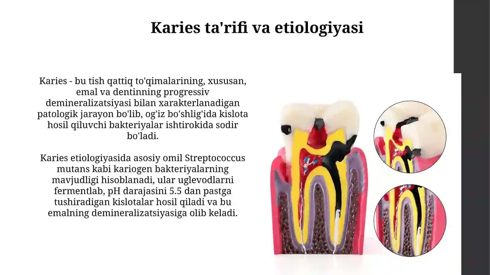 Kariesni patalogik anatomiyasi 3