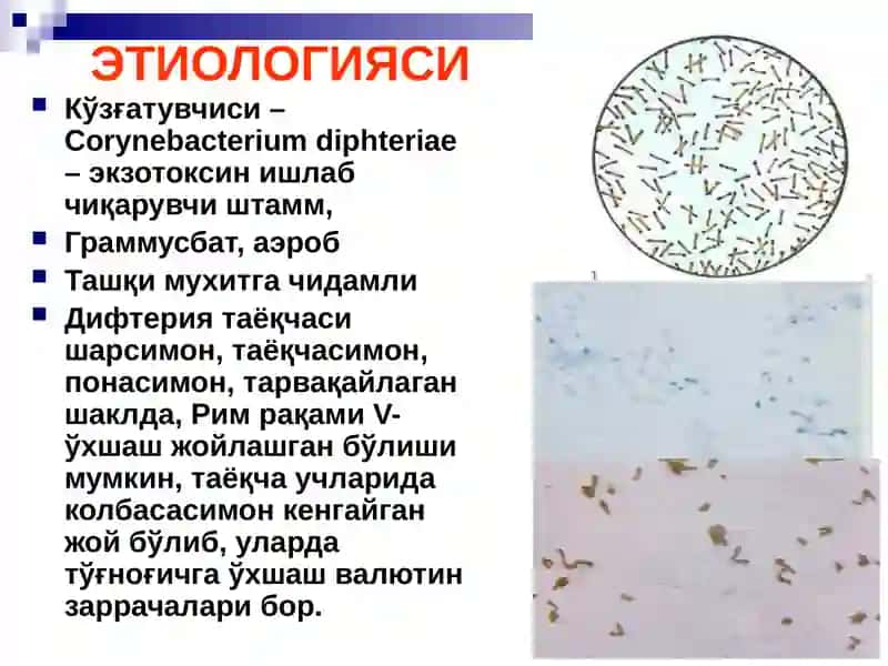 БЎҒМА – ДИФТЕРИЯ 3