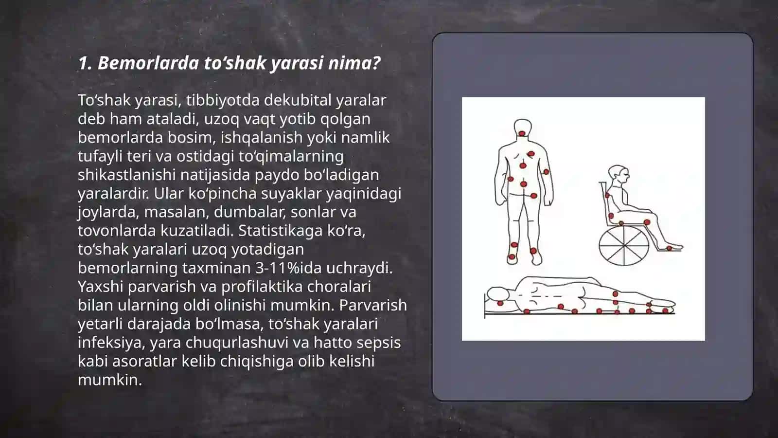 Bemorlarda Yotoq Yaralarini Oldini Olish 3