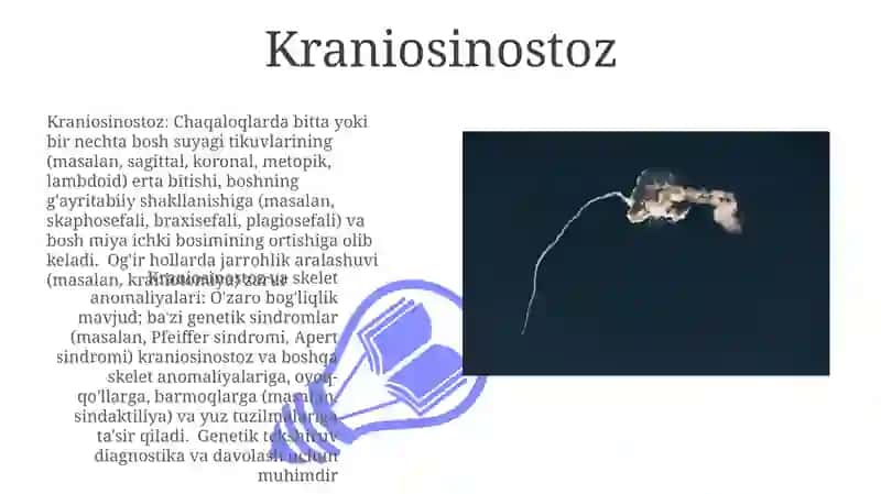 Skeletning rivojlanish anomaliyalari 3