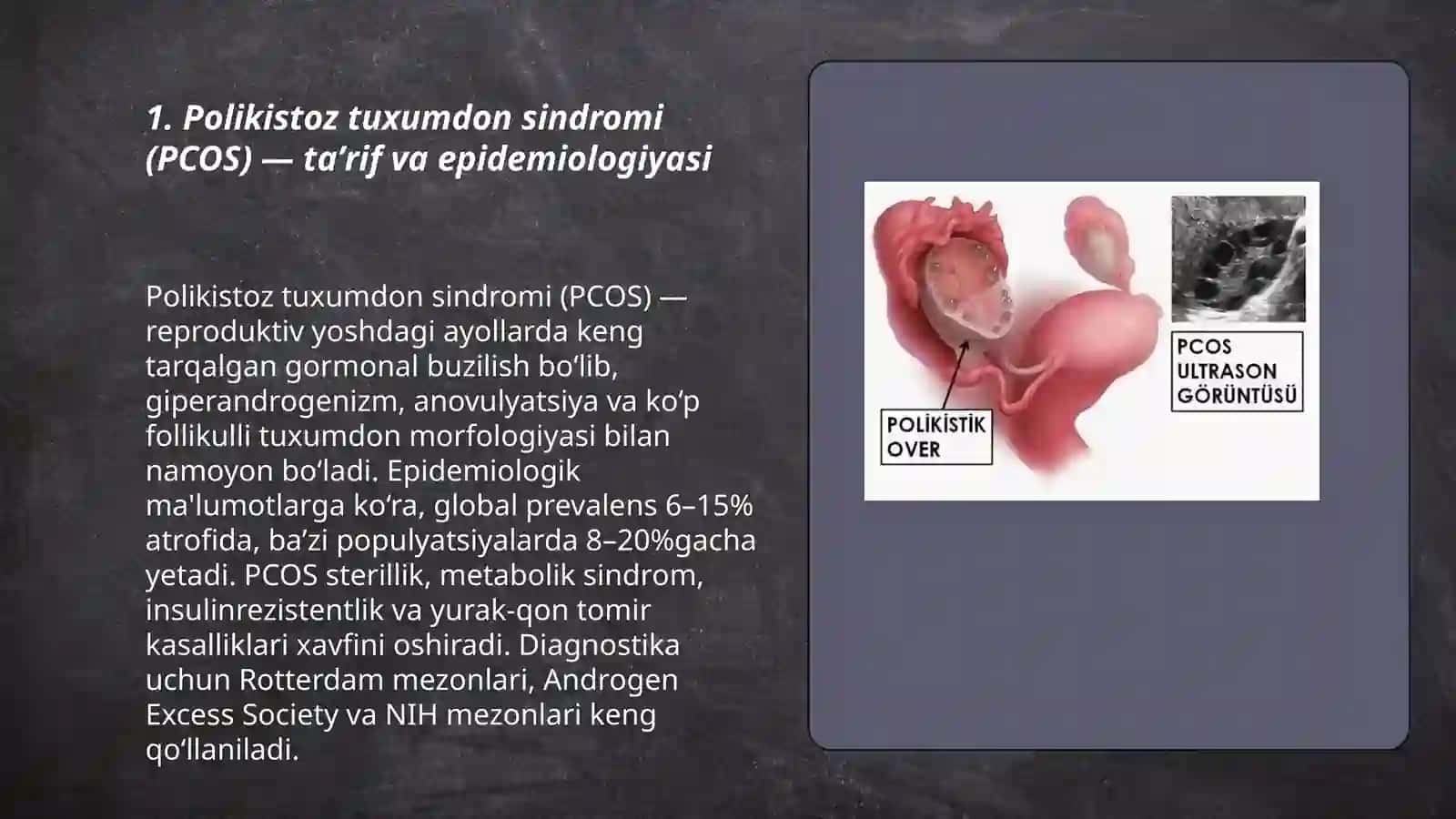 Polikistoz tuxumdon sindromi (PCOS): etiologiyasi, tashxis va zamonaviy davolash usullari 3