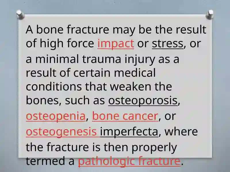 Bone fracture 3