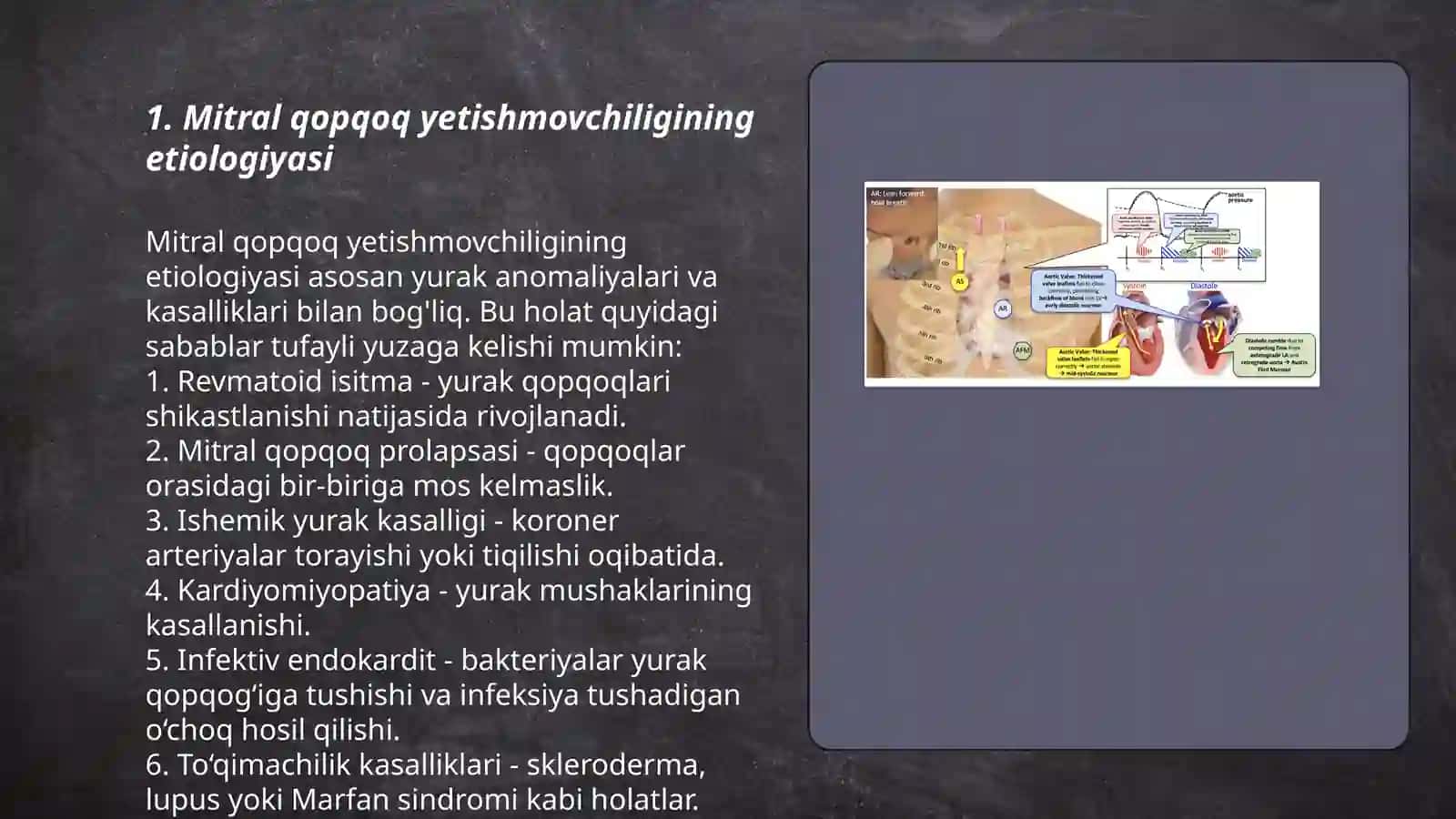 Mitral qopqog'i yetishmovchiligi va mitral stenoz(etialogiyasi, patogenez, klinika, tekshiruv uslublari kechishi davolash) 3