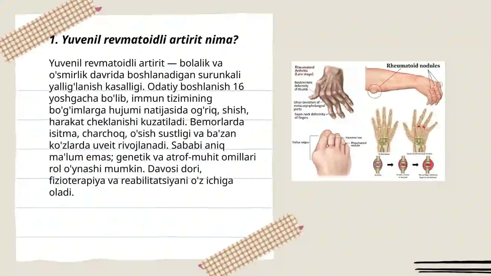 Yuvenil revmatoidli artirit 3