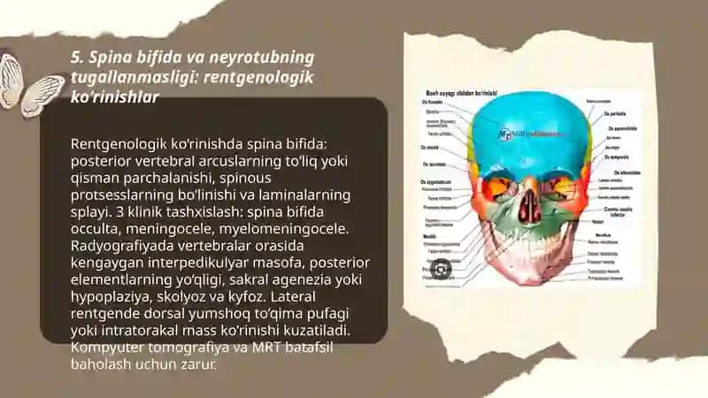 Kalla suyagining yosh va jinsga nisbatan xususiyatlari rivojlanish nuqsonlari 3