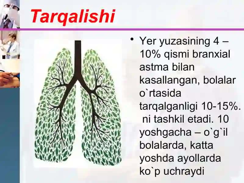 Bronxialastma Bronxialastma yuqumli allergik kasallik bo'lib davriy buginlik xurujibilan kechadi. Kasalliklar viruslar, bakteriyalar, zamburug'lar sababli yuzaga keladi. 3