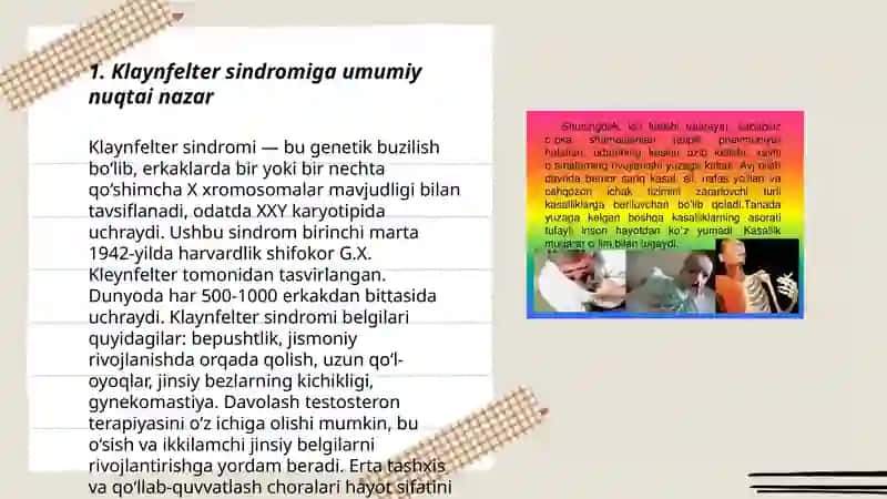 Klaynfelter sindromi kasalligi haqida tushuncha 3