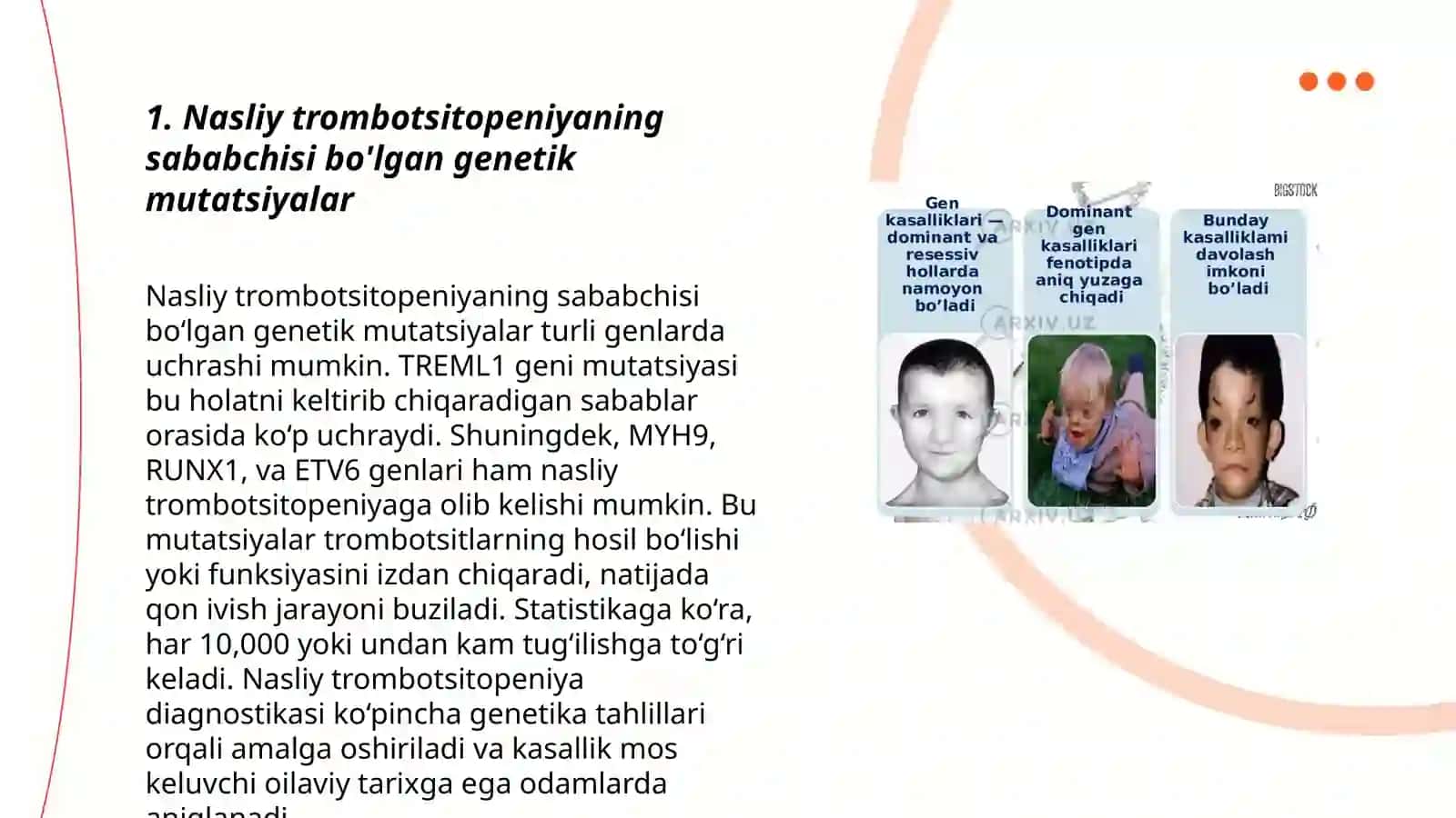 Nasliy va orttirilgan trombotsitopeniyalar 3