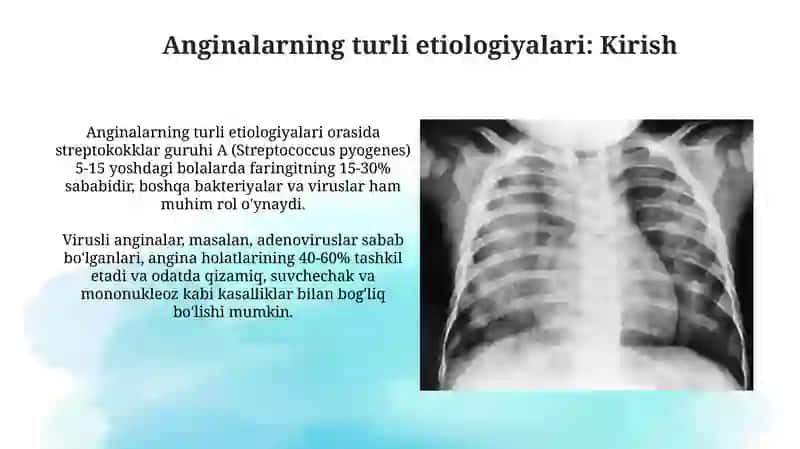 Har xil etiologiyali anginalar. Atipik pnevmoniya.Infeksiyaga bogʻliq boʻlmagan diareyalar 3
