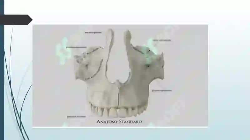 Yuqori jag’ tishlari bo’shlig’ining anatomik va topografik tuzulishi 3