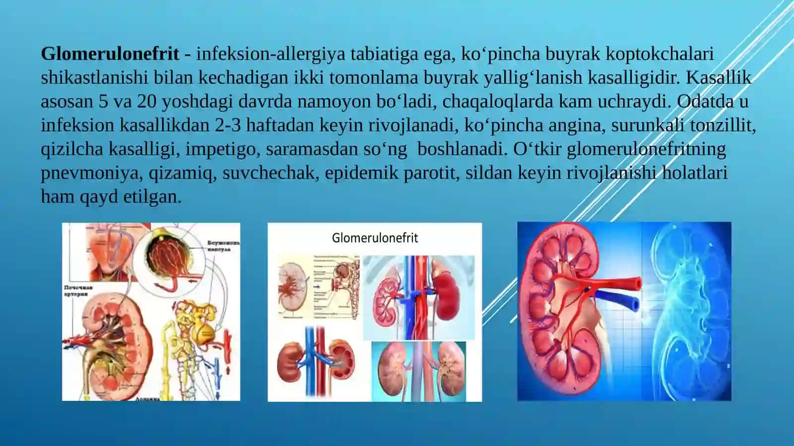 GLOMERULONEFRITLAR 3