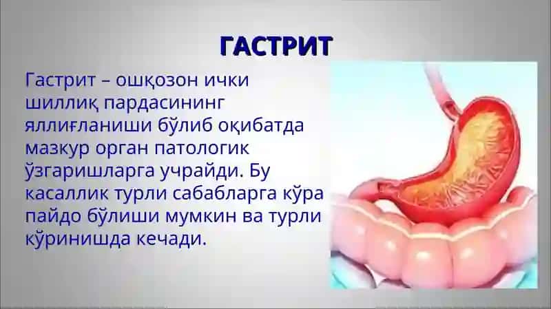 Гастрит ва гастродуоденитларнинг этиологияси, ташхисоти, клиник белгилари ва даволаш 3