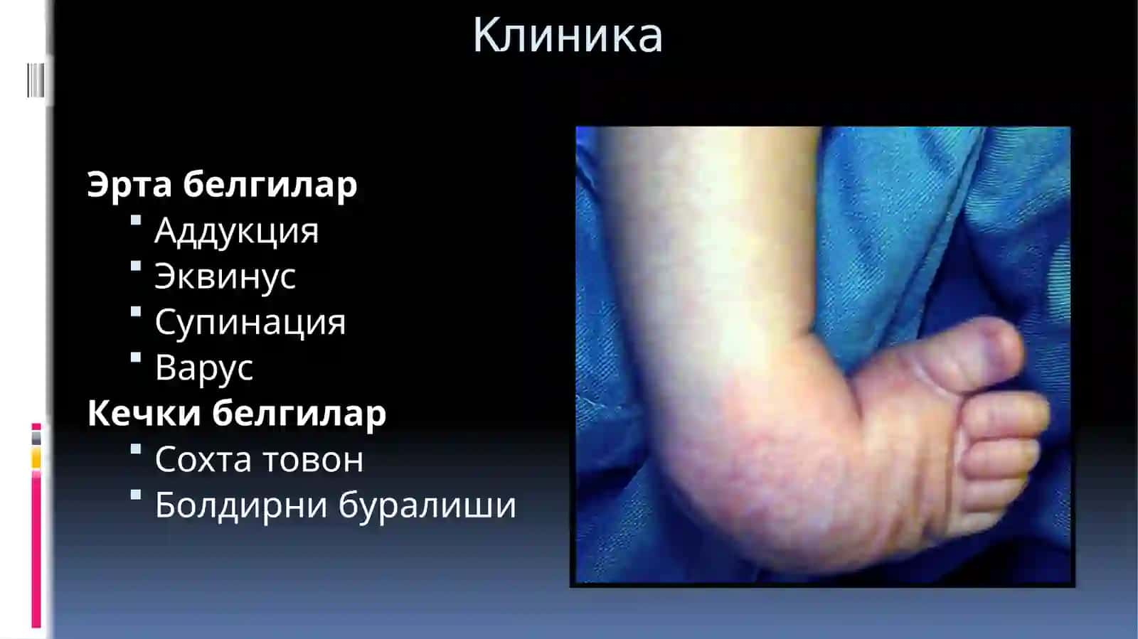 МАЙМОҚОЁҚЛИК 3