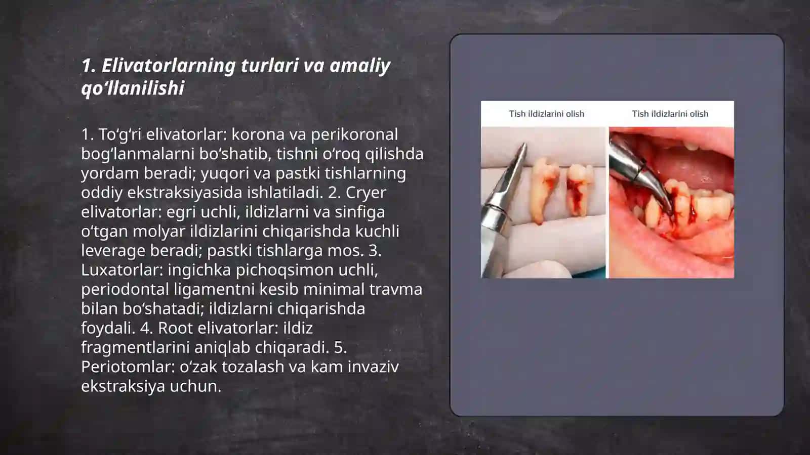 Elivator yordamida yuqori va pastki tishlarni olish texnikasi 3