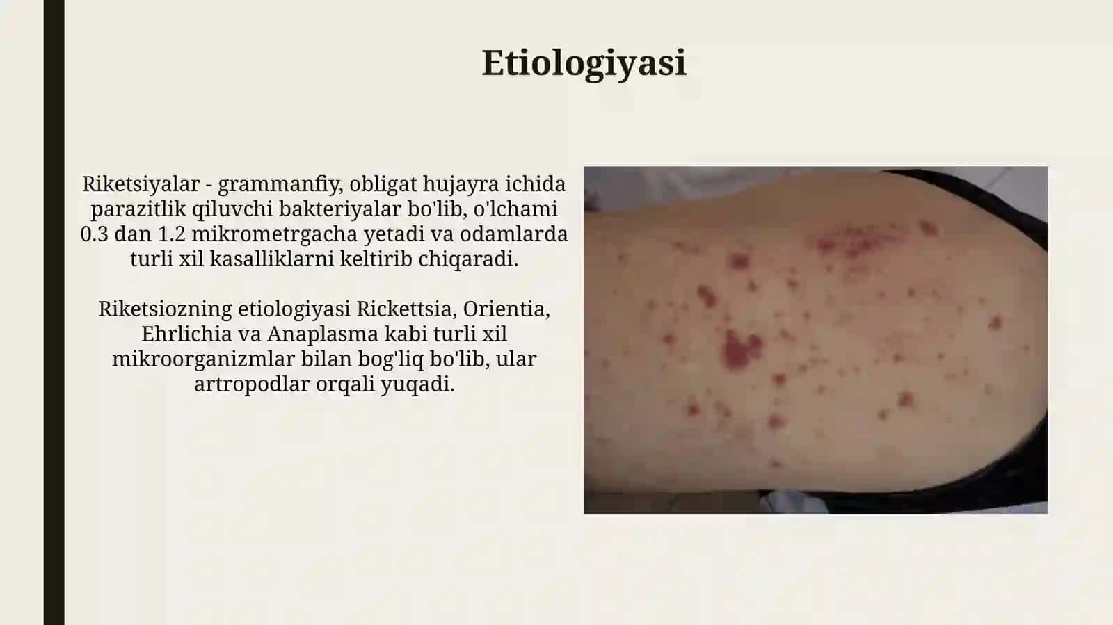 Rikketsiozlar. Etiologiyasi, epidemiologiyasi, klinikasi va davolash 3