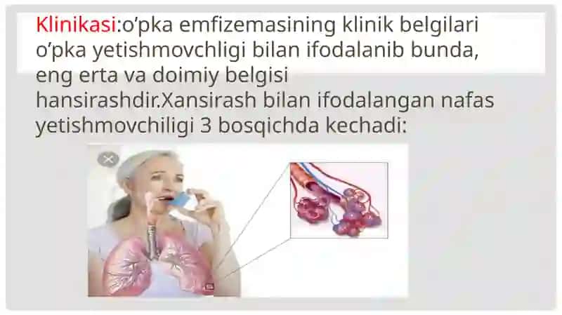 O’pkaemfizemasi etiologiyasi, klinikasi, tashxis, davolash, profilaktikasi 3