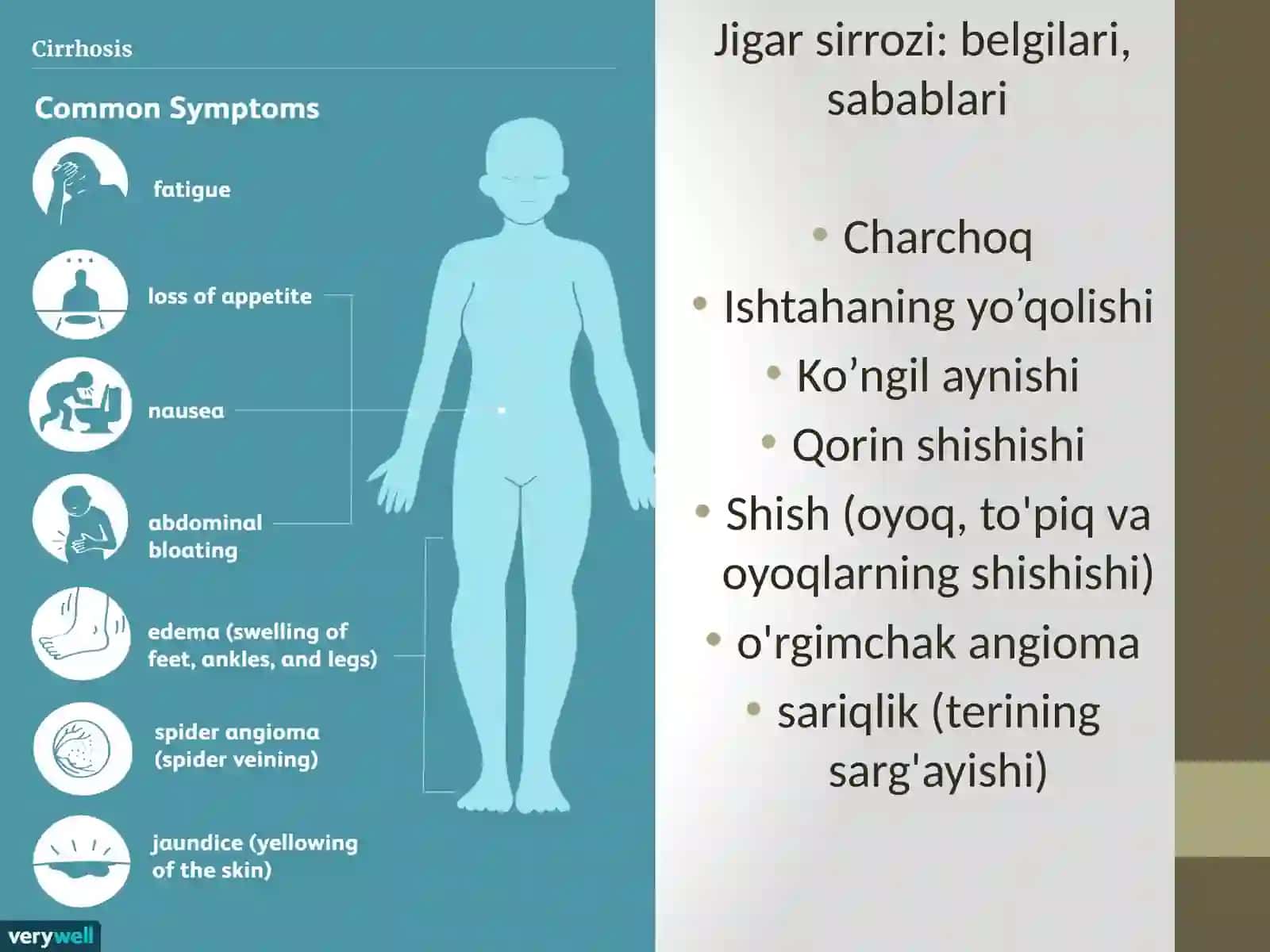JIGAR SERROZI 3