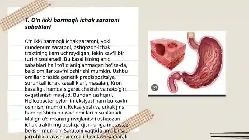 O'n ikki barmoqli ichak saratoni 3