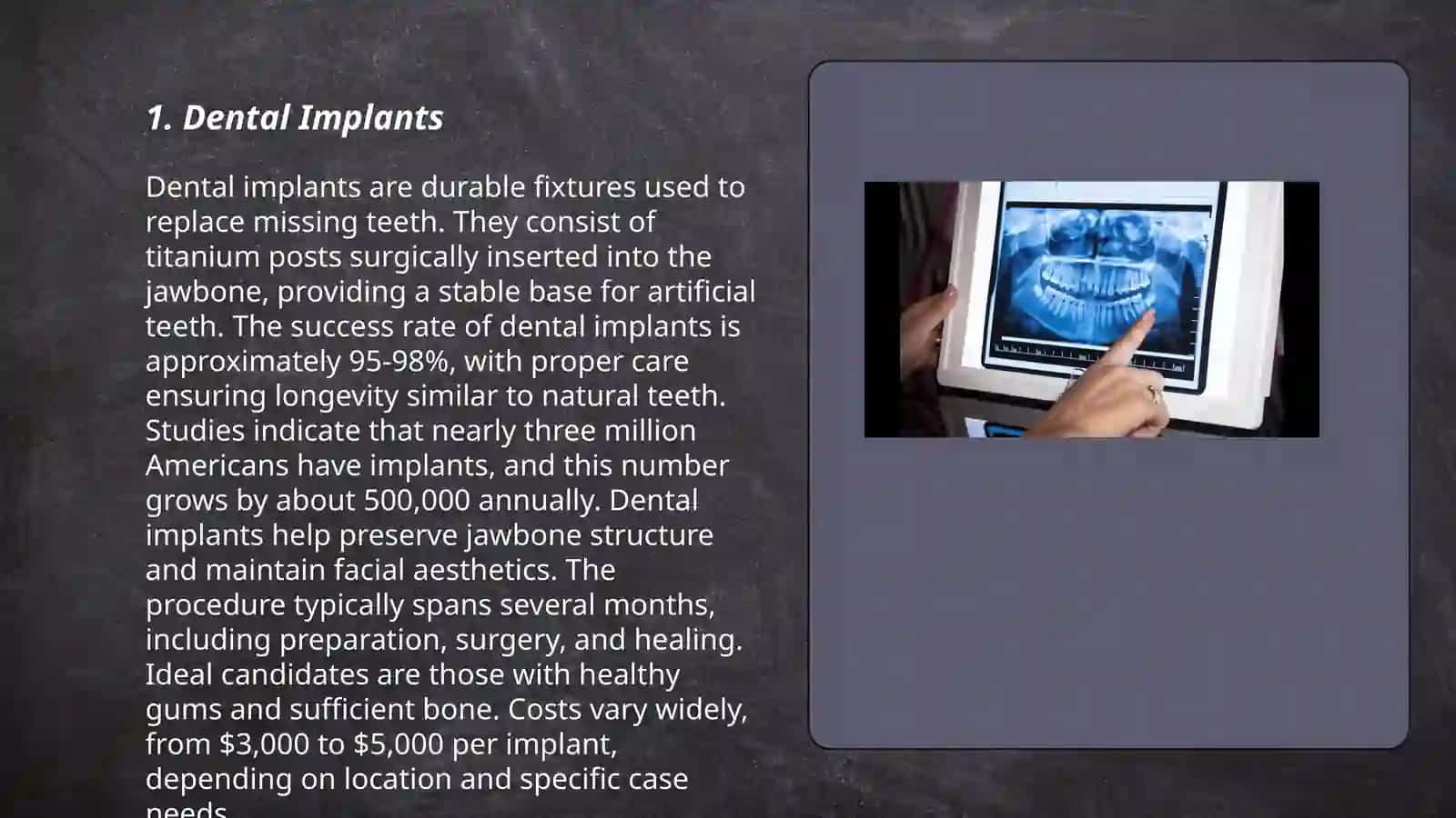 Dental Implants 3