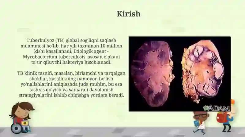 Tuberkulyozning klinik tasnifi 3