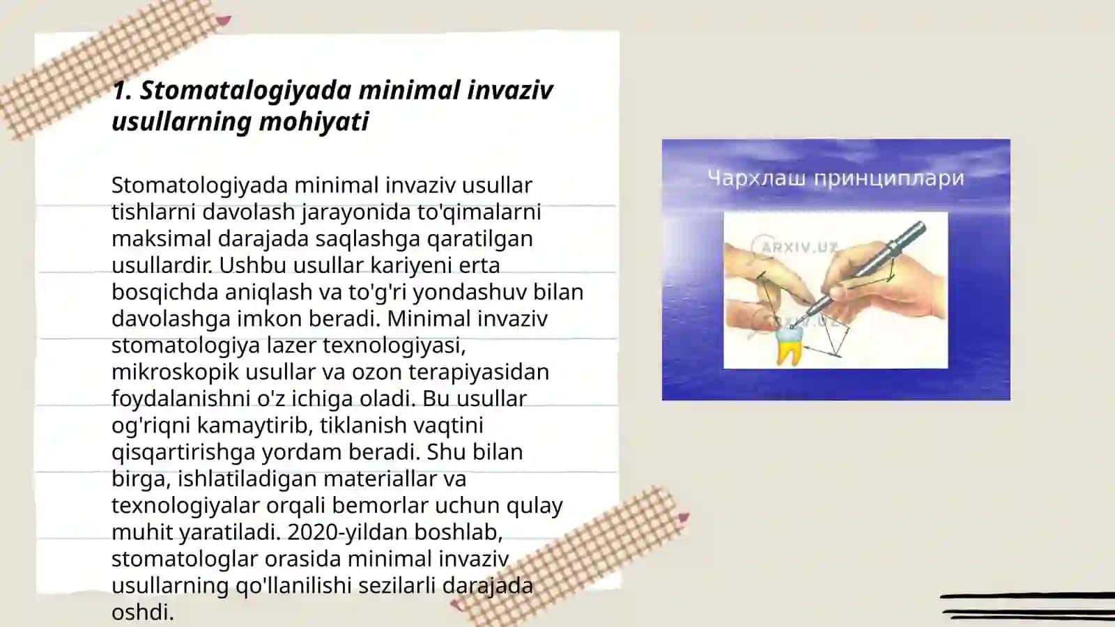 Stomatalogiya Charxlashning minimal invaziv usullari 3