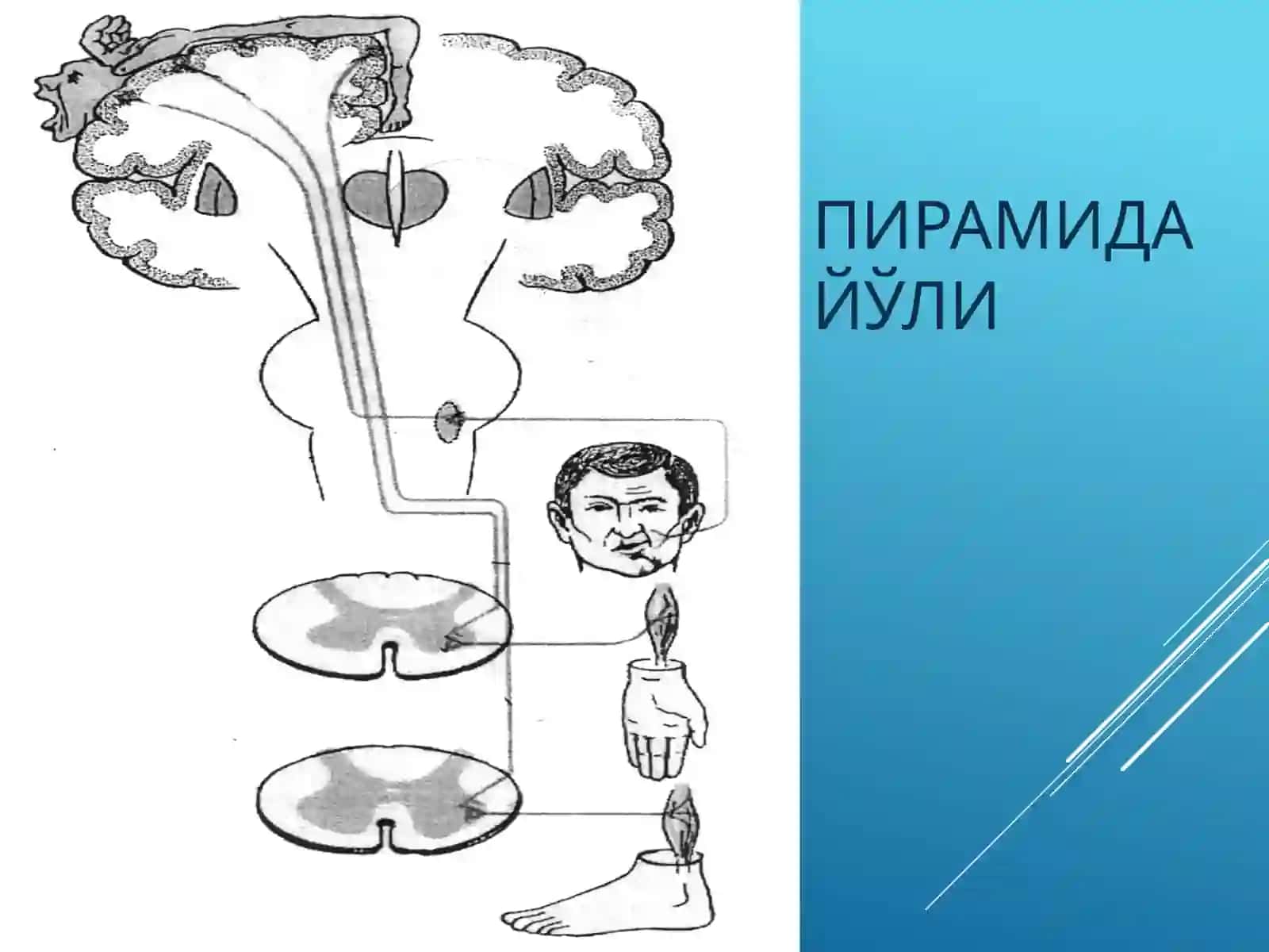 Ихтиёрий харакат тизими зарарланиш синдромлари 3