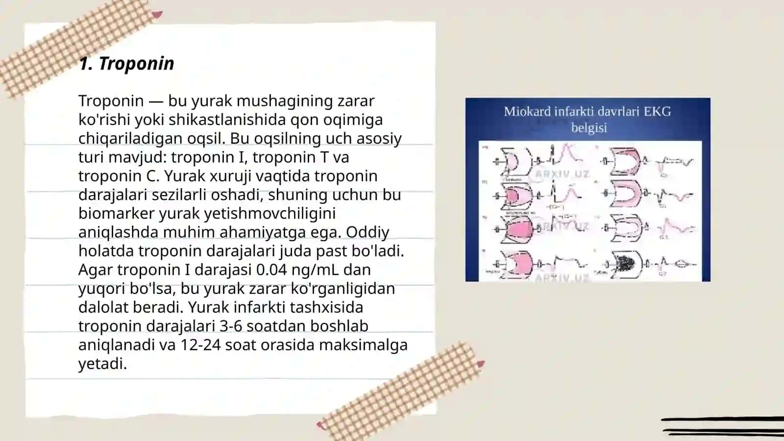 Troponin 3