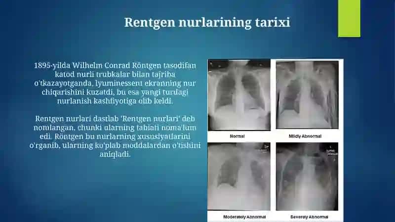 Rentgen nurlari: Asoslar, hosil bo'lishi va xususiyatlari 3