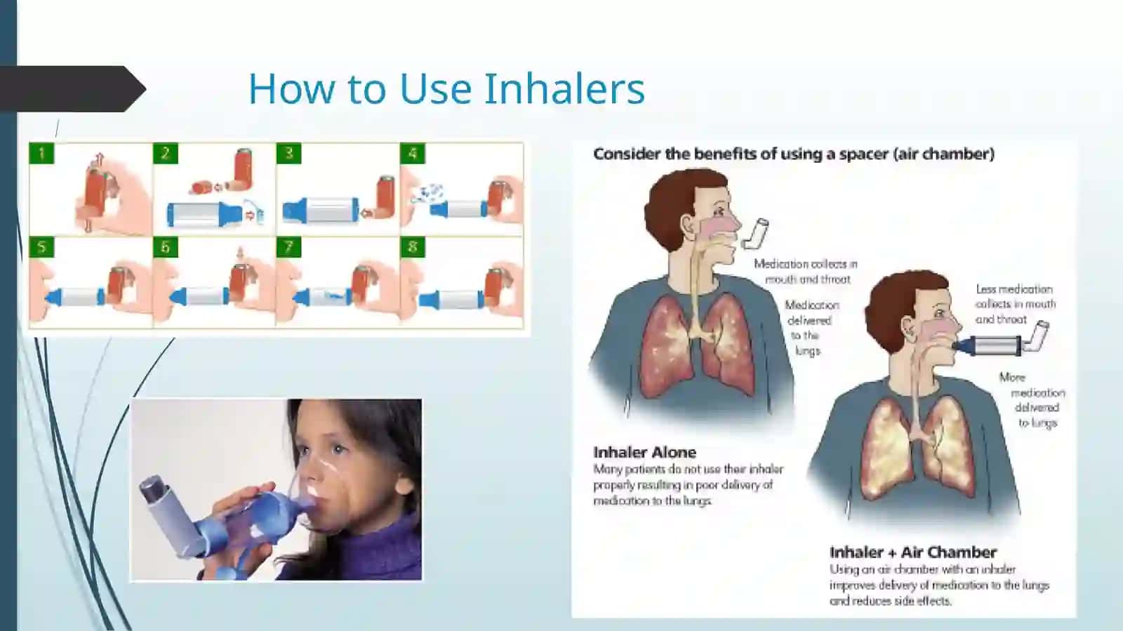 How to Use Inhalers: MDI 3