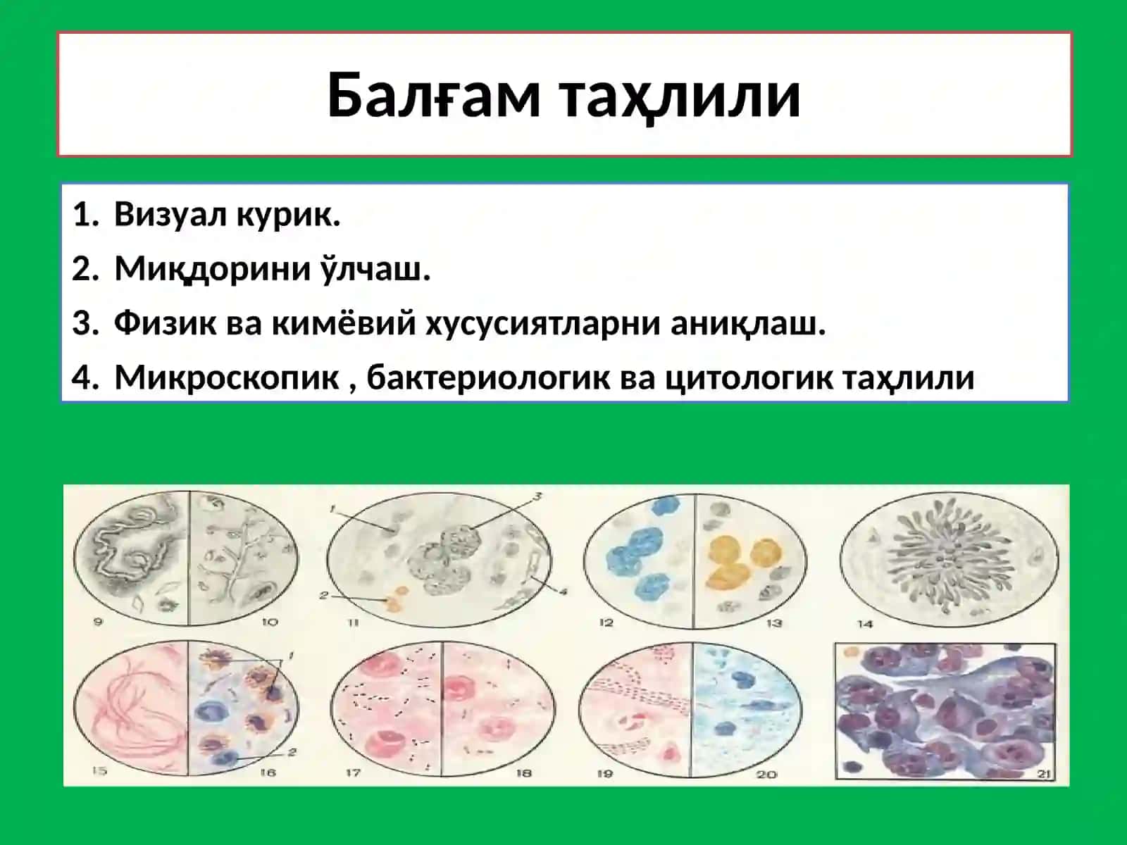 Нафас азоларикасалликларида балғам таҳлили 3