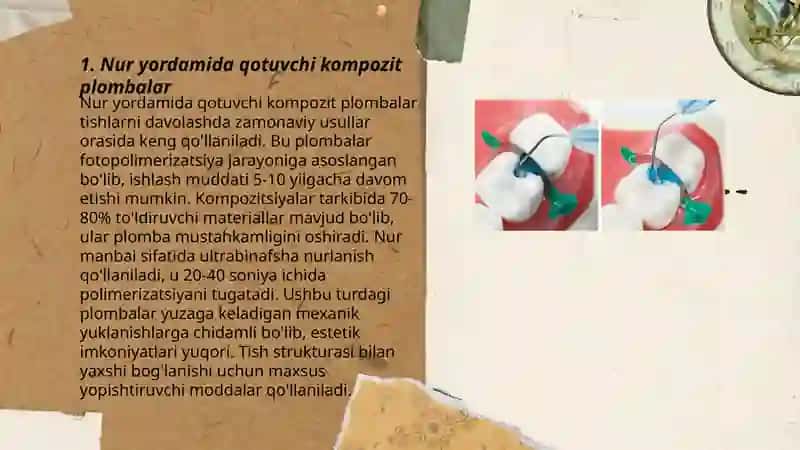 Nur yordamida qotuvchi kompozit plombalar 3