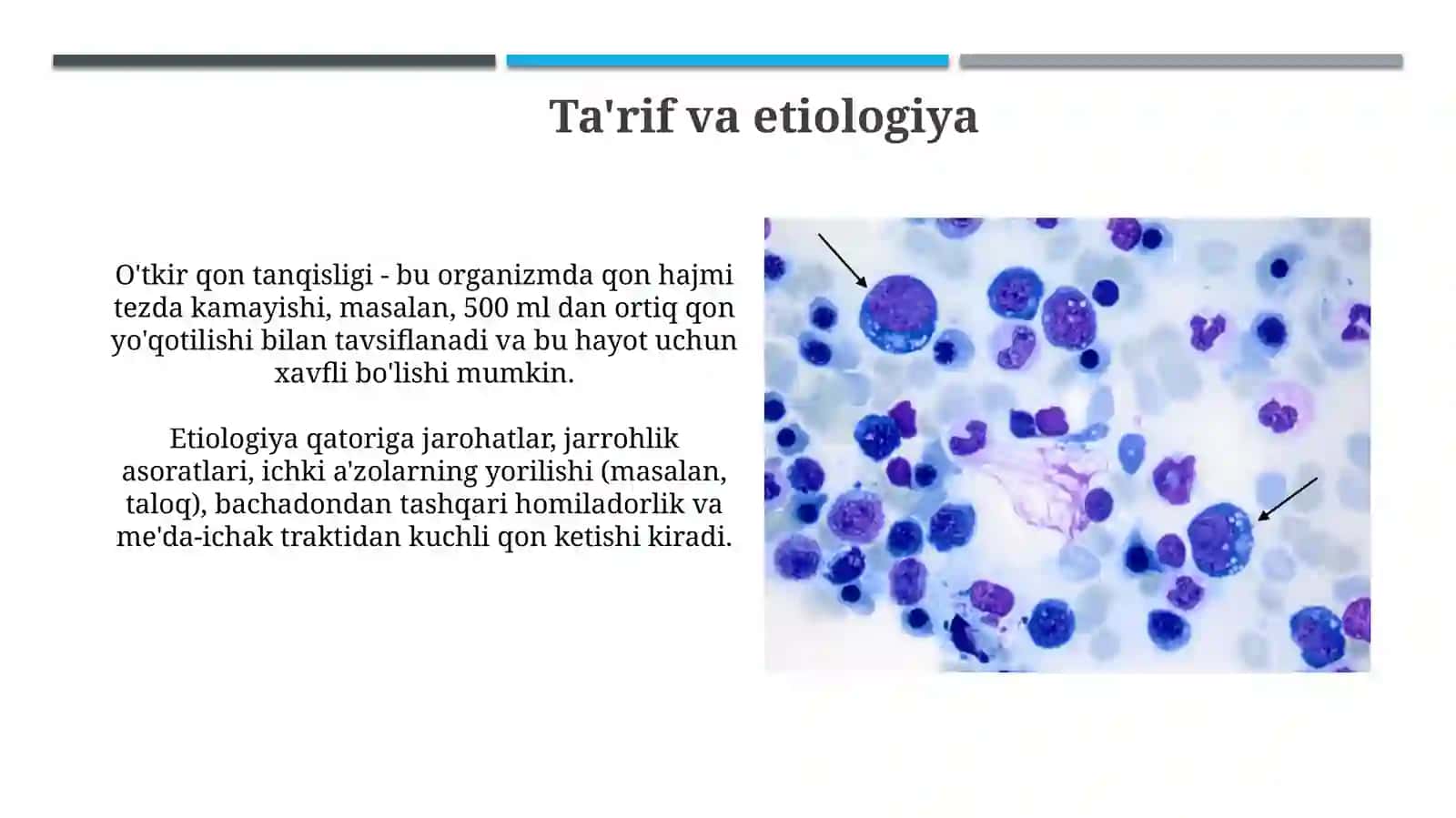 O'tkir qon tanqisligi 3