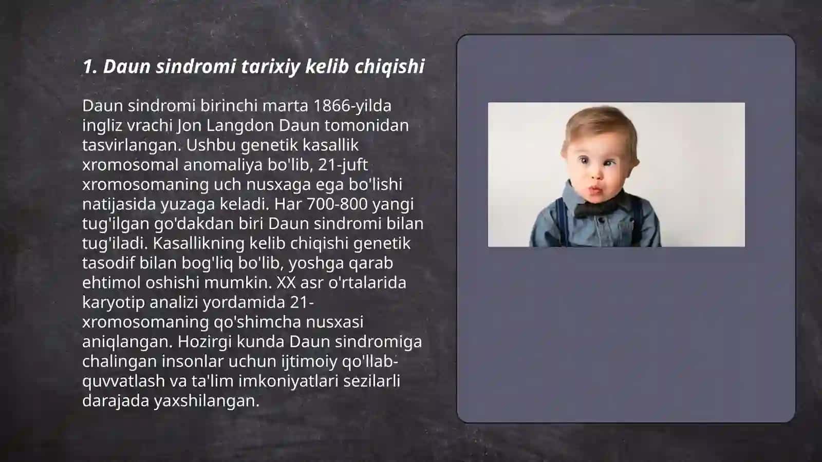 Daun sindromi 3