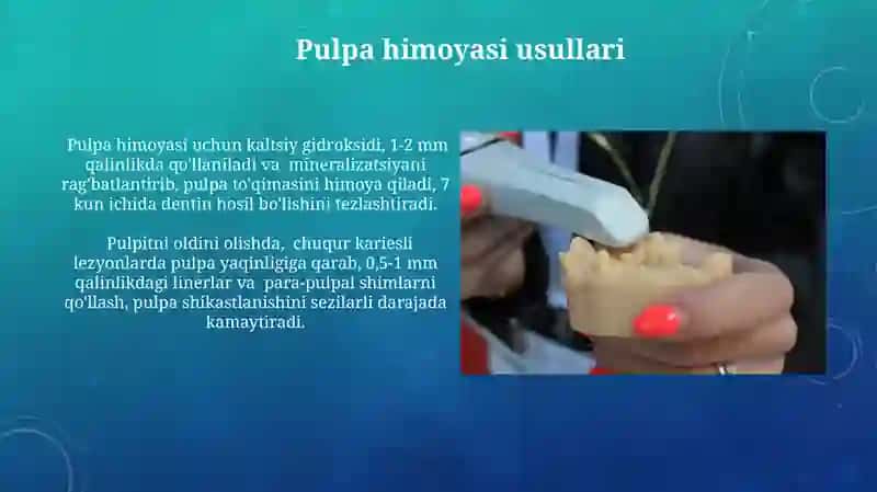 Pulpa himoyasi usullari 3