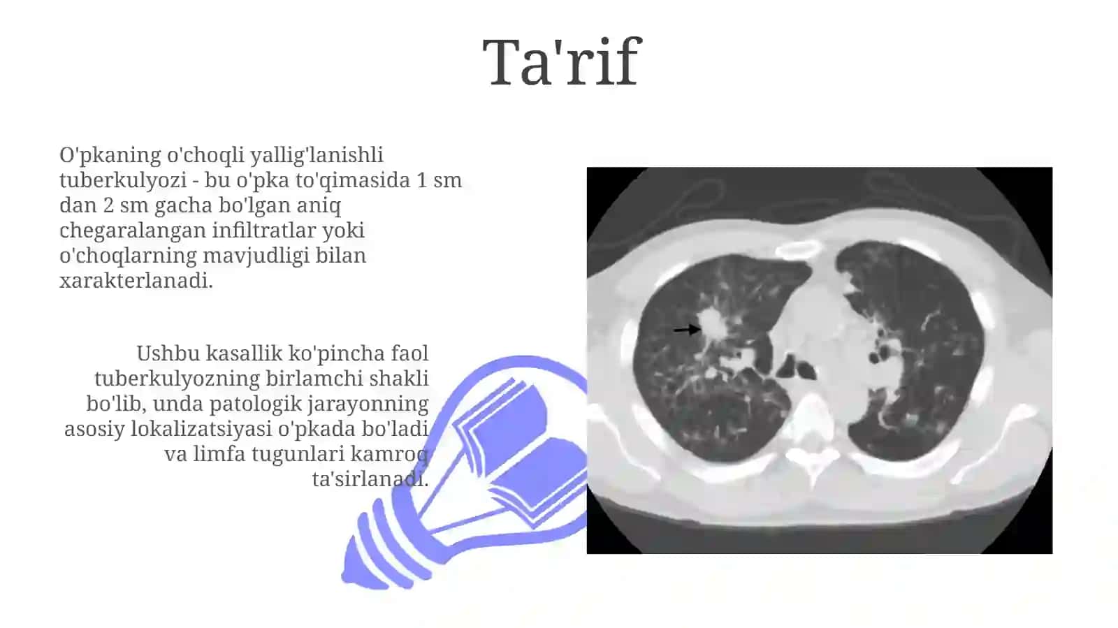 O‘pkaning o‘choqli, yallig'langan tuberkulyozi 3