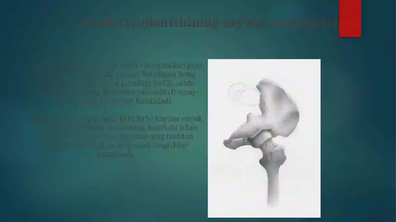 Suyaklarning rivojlanish buzilishi patanatomiyasi. Sinish. Osteonekroz 3