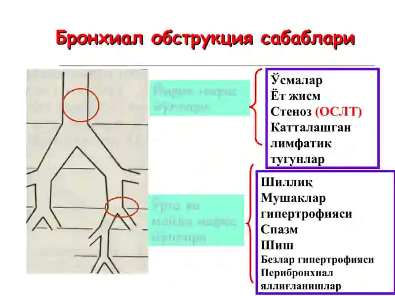 Болаларда бронхообструктив синдром. Диагностика. Даволаш. Профилактика. 3