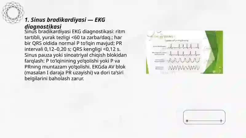 Yurak aritmiyalari EKG diagnostikasi 3
