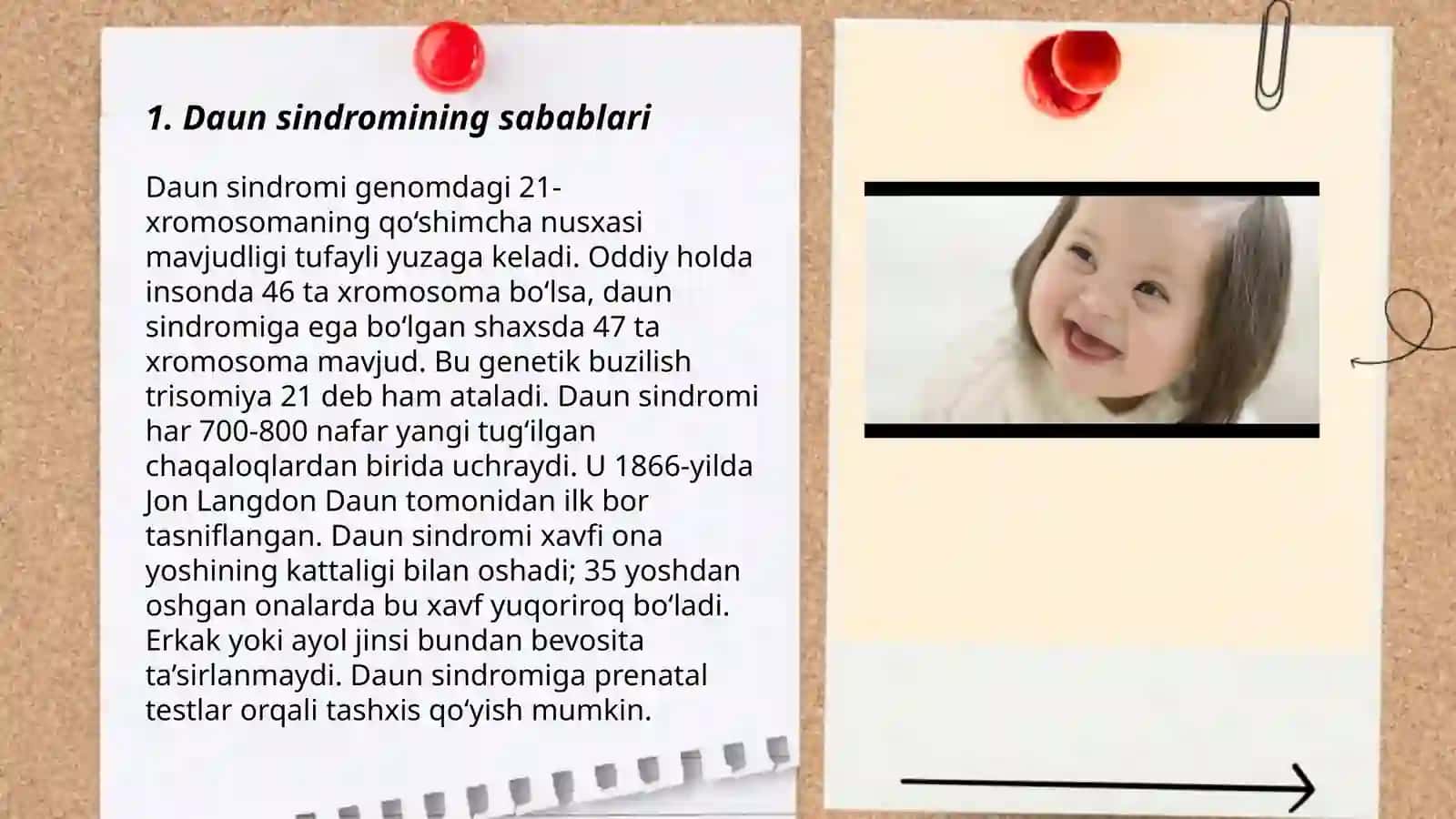 Daun sindroʼmi 3